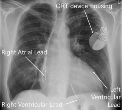 Medical background | CART-Tech.com